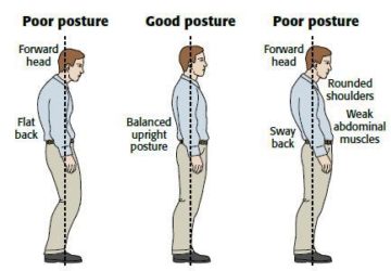 3 Exercises to Improve Posture